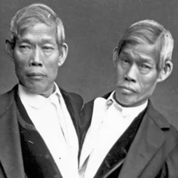 Black-and-white photo of conjoined twin men in suits, facing slightly different directions.